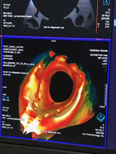 Result of MRI capture, horizontal section views of the elastomer sculpture and 3D reconstruction of its body, CRMBM, Marseille, 2021